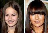 Nose Surgery Gone Wrong